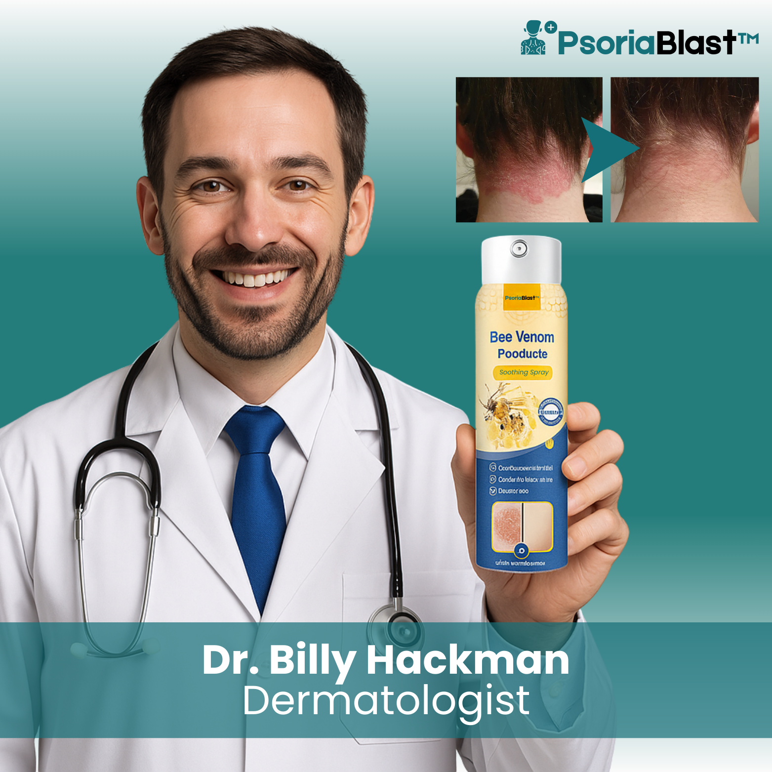 PsoriaBlast™ Bee Venom Psoriasis Spray