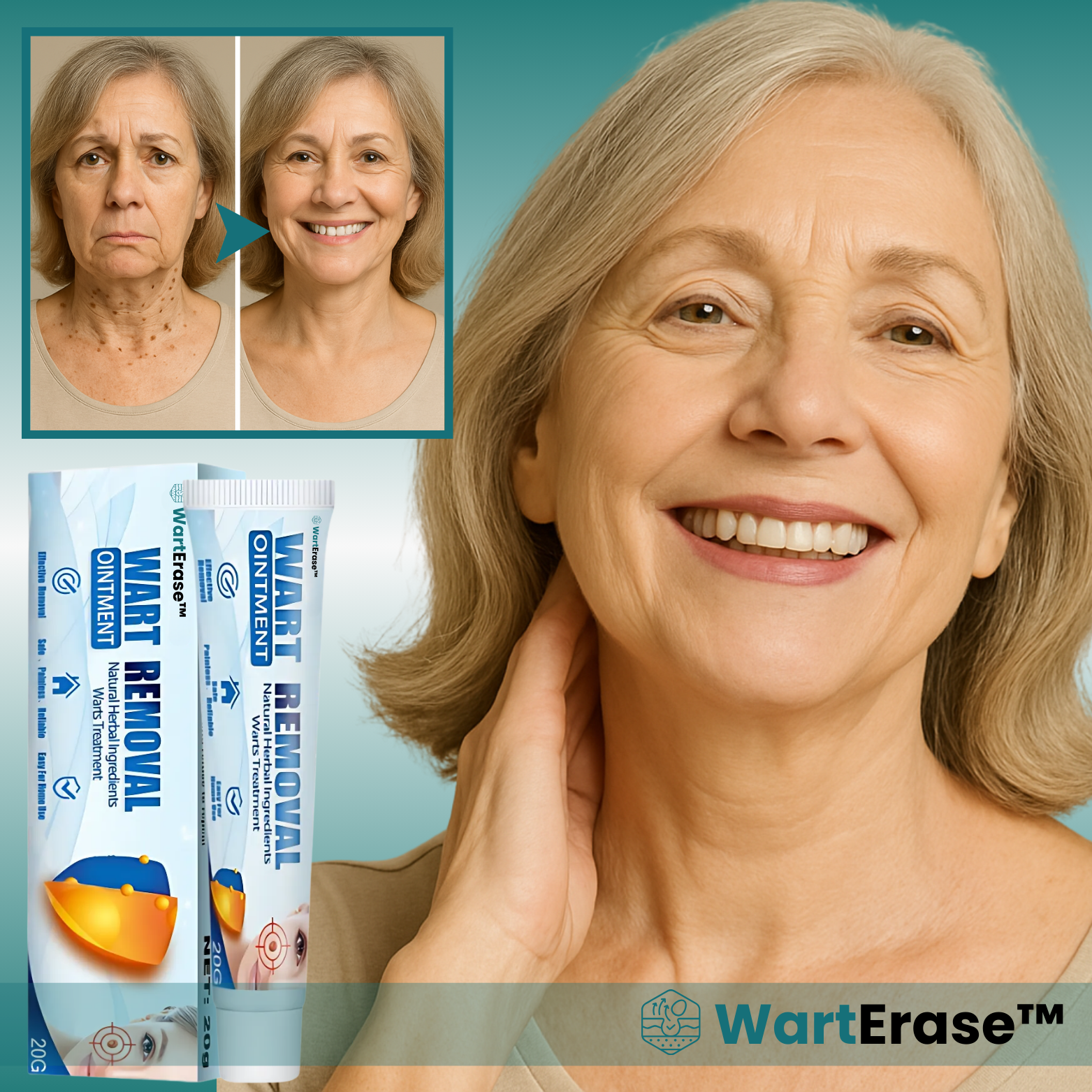WartErase™ Instant Wart & Skin Tag Remover