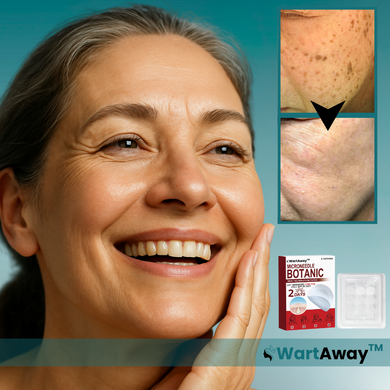 WartAway™ Wart Removal